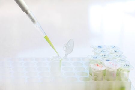 Clinical laboratory in process of chemical analysis. Collection of probe using automatic pipette.