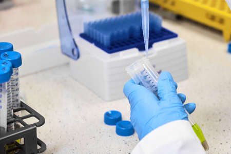 Scientist spikes samples using an automatic pipette. Sample preparation procedure in chemical...