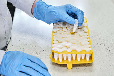 Scientist in a blue rubber gloves is take of a tube with white reagent from the rack. Chemical...
