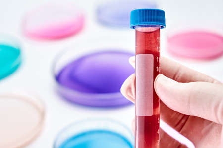 Blood sample in a plastic test tube on the background of Petri dish with colorful liquids or media. Microbiology or chemical research.の写真素材