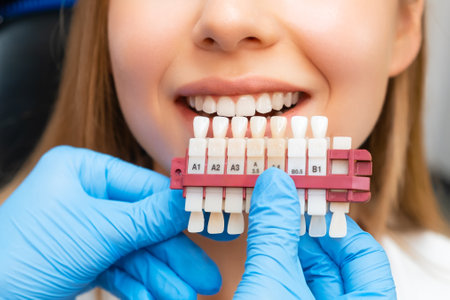 Set of implants with various shades of tone for whitening of teeth and perfect woman smile.