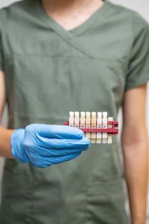 Dentist holding teeth shade guide for whitening in hand,の写真素材