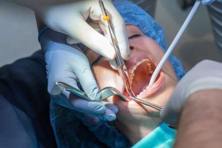 Dentist works in woman open mouth manipulating thin thread with forceps. Assistant helps manage area...
