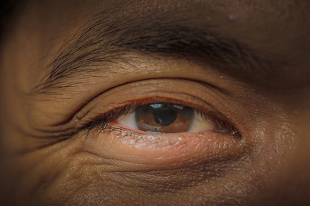 Wrinkles around the eyesの写真素材