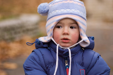 Drooling  boy with a runny nose from a cold