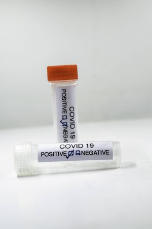 Positive COVID-19 test and laboratory sample of blood testing for diagnosis new Corona virus...