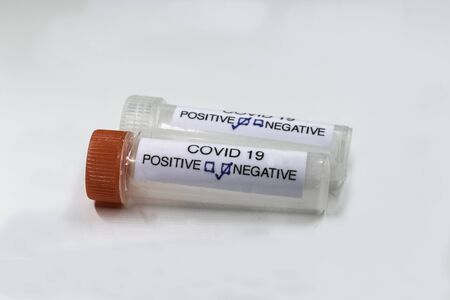 Testing for presence of coronavirus. Tube containing a swab sample that has tested positive for COVID-19.の写真素材