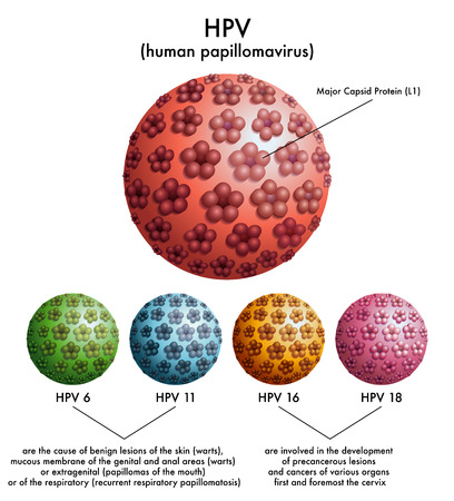 HPV  human papillomavirus のイラスト素材