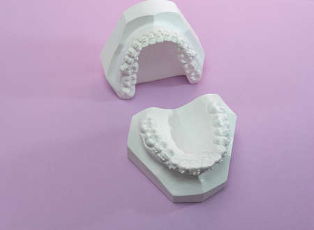 Dental model plaster cast or mold human jaws prothetic on colored background