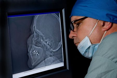 A medical doctor examining a CTT Scan.