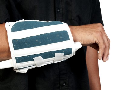 An African American man with a broken armの写真素材