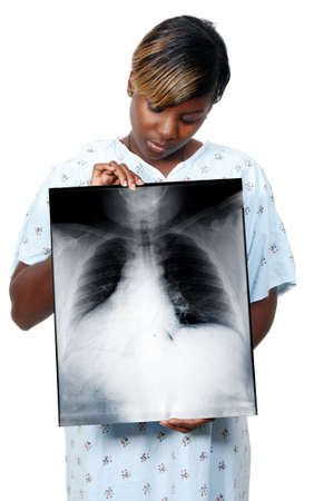 A beautiful woman black African American woman patient holding an x-rayの写真素材