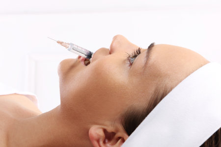 Portrait of a white woman during surgery filling facial wrinkles, Cosmetic is injected into facial skin cosmeticsの写真素材