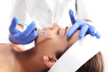 Portrait of a white woman during surgery filling facial wrinkles, Cosmetic is injected into facial skin cosmeticsの写真素材