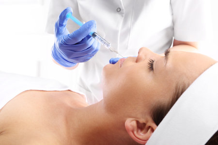 Portrait of a white woman during surgery filling facial wrinkles, Cosmetic is injected into facial skin cosmeticsの写真素材