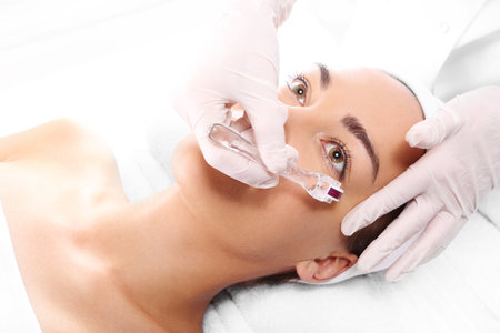 Rejuvenation, beautification, the woman at the beautician, Mesotherapy microneedleの写真素材