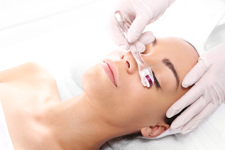 Rejuvenation, beautification, the woman at the beautician, Mesotherapy microneedleの写真素材