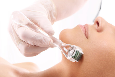 Rejuvenation, beautification, the woman at the beautician, Mesotherapy microneedle