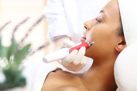 Microneedle mesotherapy, treatment for neck, the woman at the beauticianの写真素材