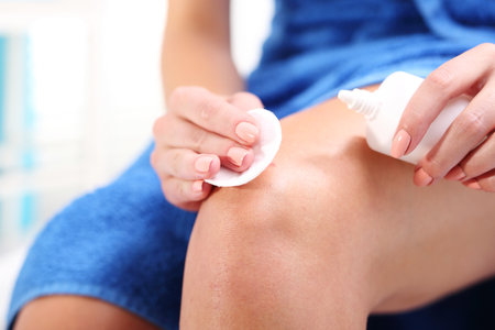 Disinfection of wounds with hydrogen peroxide. Female disinfects the wound on his knee pouring with oxygenated water.の写真素材