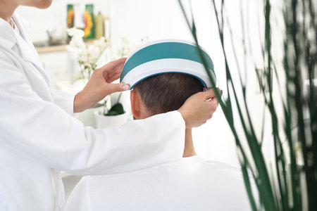 Male pattern baldness. Hair strengthening treatment.の写真素材