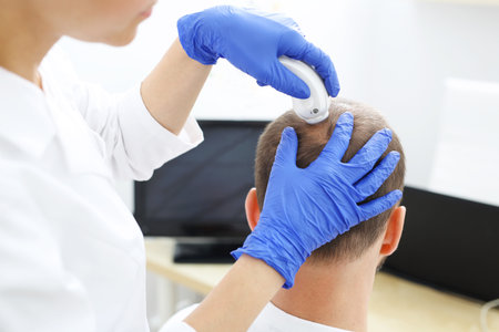 Microscopic analysis of the condition of hair and scalp. The head of a hair with the microscopeの写真素材