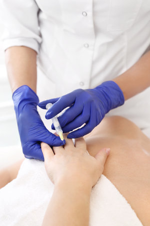 Hand needle mesotherapy. Beautician injects a vitamin cocktail under the skin of a woman's hand. A rejuvenating cosmetic procedure.の写真素材
