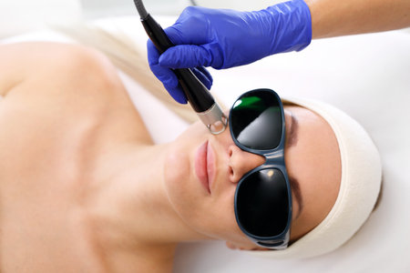 Fractional laser, photorejuvenation of the skin. A woman in a beauty salon during a laser treatment.の写真素材