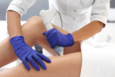 Cellulite, body shaping. The beautician performs the treatment using the machine.の写真素材