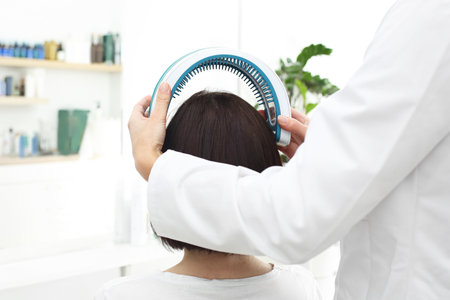 Laser for hair and scalp. A woman with thin and weak hair in a doctor's office.の写真素材