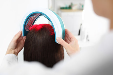 Laser therapy for scalp and hair.の写真素材