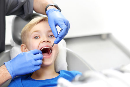Child at the dentist. Tooth treatment, the dentist cleans the cavityの写真素材