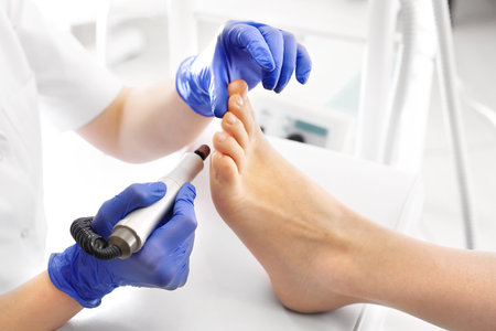 Milling pedicure. The beautician is filing the calluses on the footの写真素材