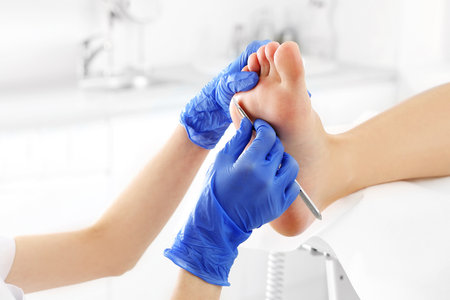 Podiatry. Removing calluses with a scalpel at the beautician.の写真素材