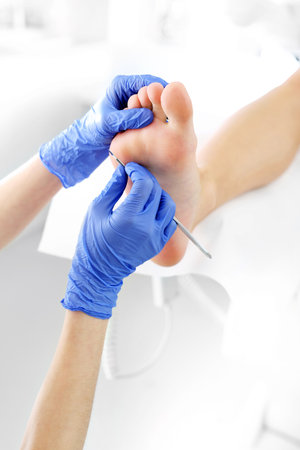 Podiatry. Removing calluses with a scalpel at the beautician.の写真素材