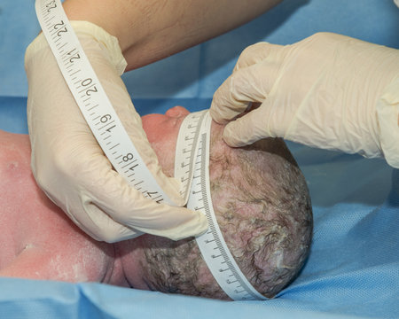 Infant child having his head measured after delivery at hospitalの写真素材