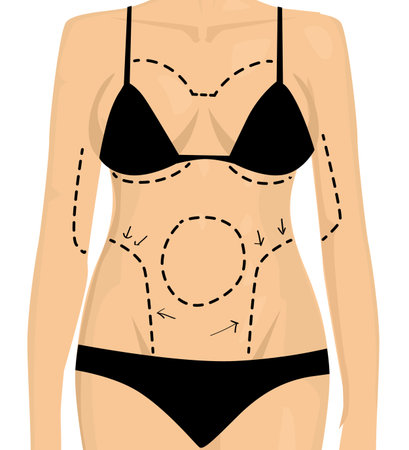 Woman is preparing to plastic surgeryのイラスト素材