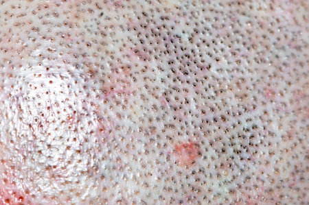 Detail of head with shaved hair. Macro photo of shaved head.の写真素材