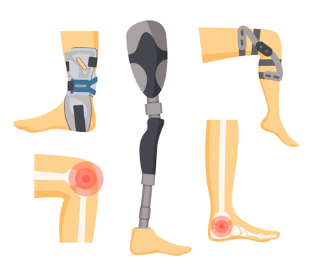 Pain in joints and orthopedic retainers on legs colorful vector illustration with white human s bones, red dots of ache surfaces, medical prosthesisのイラスト素材