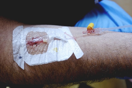 Arm during the drip
