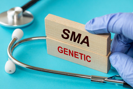 SMA disease, Doctor shows wooden blocks with words SMA Genetic. spinal muscular atrophy. Doctor's stethoscope, Beautiful blue background. Health conceptの写真素材