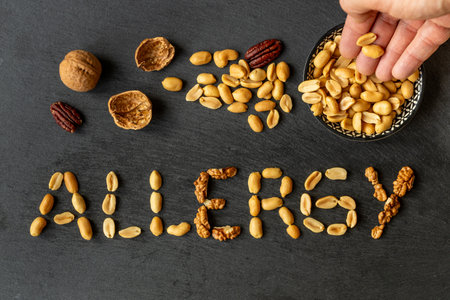 Nut allergy. The word ALLERGY is made up of various nuts. The concept of health. Immune system...