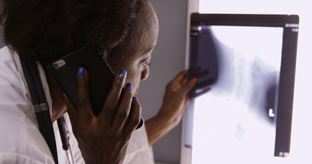 Senior female African doctor discussing x-ray with colleague over cell phoneの写真素材