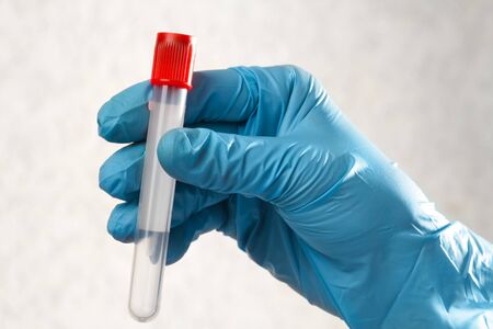 a doctor's hand in a sterile glove holds a clean blood test tubeの写真素材
