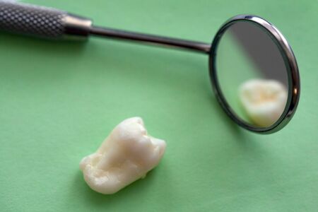 Real Human Wisdom tooth and Dental Mirrorの写真素材