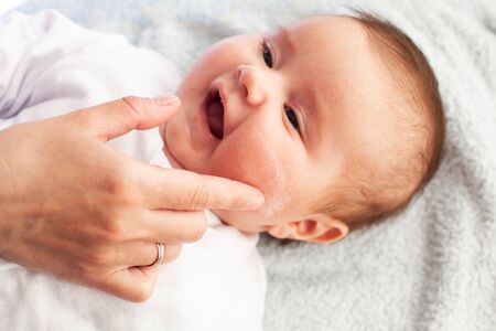 Baby with atopic dermatitis getting cream put. Care and Prevention Of Eczema. Keep Your Baby From Itchingの写真素材
