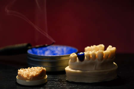 Dental technician work. Prosthesis production. Dental still life. Model of the upper jaw.の写真素材