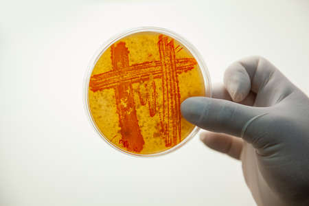 The scientist holds in his hand a Petri dish with marked areas of bacterial growth. Gloved Hand...