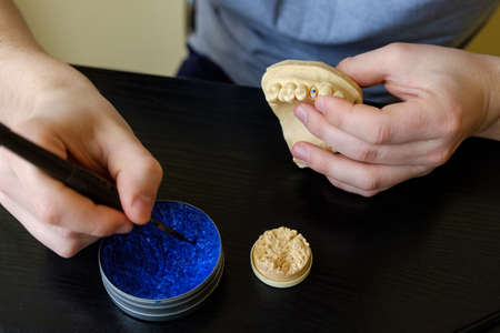 Dental technician modelling tooth crowns with hot wax. Workplace of a dental technicianの写真素材