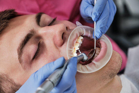 A female dentist treats tooth decay on a male patient's teeth at a dental clinic. A dentist doctor...
